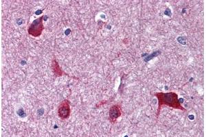 Human Brain, cortex: Formalin-Fixed, Paraffin-Embedded (FFPE)