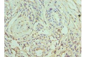 Immunohistochemistry of paraffin-embedded human epityphlon tissue using ABIN7169786 at dilution of 1:100 (SLAMF7 anticorps  (AA 23-226))