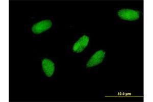 Immunofluorescence of monoclonal antibody to TCEA3 on HeLa cell. (TCEA3 anticorps  (AA 1-348))