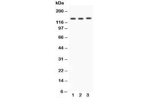 Western blot testing of Integrin alpha 1 antibody and Lane 1:  rat brain;  2: HeLa;  3: SW620;  Predicted size: 131KD;  Observed size: 131KD (Integrin alpha 1 anticorps  (C-Term))