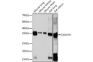 Western blot analysis of extracts of various cell lines, using Calponin Rabbit mAb (ABIN1678670, ABIN3018018, ABIN3018019 and ABIN7101568) at 1:1000 dilution.