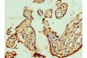 Immunohistochemistry of paraffin-embedded human placenta tissue using ABIN7143011 at dilution of 1:100 (PHAP1 anticorps  (AA 1-170))