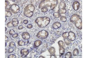 Immunoperoxidase of monoclonal antibody to OXSR1 on formalin-fixed paraffin-embedded human small Intestine. (OXSR1 anticorps  (AA 1-527))