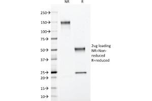 SDS-PAGE Analysis Purified Annexin A1 Mouse Monoclonal Antibody (ANXA1/3566).