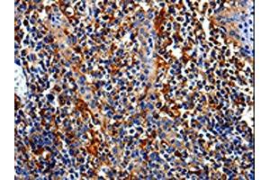 The image is immunohistochemistry of paraffin-embedded Human tonsil tissue using ABIN7129010(COX16 Antibody) at dilution 1/50. (COX16 anticorps)