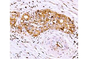 IHC analysis of AGPAT2 using anti-AGPAT2 antibody (ABIN7602435).