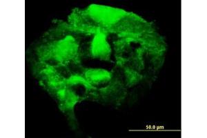 Image no. 5 for anti-3'-phosphoadenosine 5'-phosphosulfate Synthase 2 (PAPSS2) (AA 513-613) antibody (ABIN598592) (PAPSS2 anticorps  (AA 513-613))