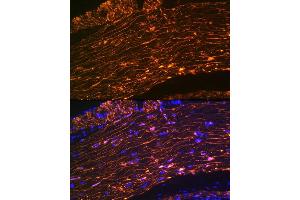 Immunofluorescence analysis of rat rectum using Calponin Rabbit mAb (ABIN1678670, ABIN3018018, ABIN3018019 and ABIN7101568) at dilution of 1:100 (40x lens).