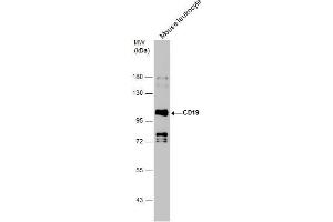 WB Image Mouse tissue extract (50 μg) was separated by 7.