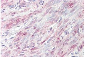 Image no. 2 for anti-BRISC and BRCA1 A Complex Member 1 (BABAM1) (AA 36-85) antibody (ABIN6749759)