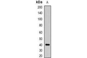 Western blot analysis of ABO expression in K562 (A) whole cell lysates. (ABO anticorps)