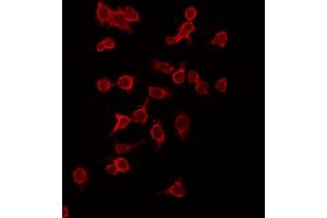 ABIN6269133 staining HepG2 by IF/ICC. (KIT anticorps  (Internal Region))