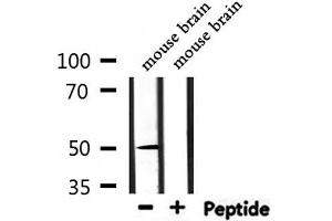 Western blot analysis of extracts from mouse brain, using NR1H3 Antibody.