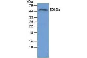 Detection of IL6R in Rat Liver Tissue using Polyclonal Antibody to Interleukin 6 Receptor (IL6R) (IL-6 Receptor anticorps)