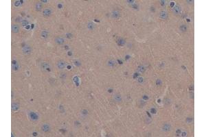 Detection of MAP6 in Mouse Brain Tissue using Polyclonal Antibody to Microtubule Associated Protein 6 (MAP6) (MAP6 anticorps  (AA 177-387))