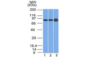 Western blot testing of human 1) U87, 2) HeLa and 3) A431 cell lysate with Plakophilin 1 antibody (clone 10B2). (Plakophilin 1 anticorps  (N-Term))
