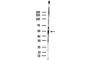 anti-N-Myc Downstream Regulated 1 (NDRG1) (C-Term) antibody