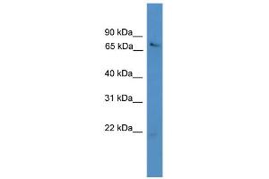 WB Suggested Anti-USP2 Antibody Titration: 0. (USP2 anticorps  (N-Term))