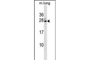 Mouse Cbx5 Antibody (C-term) (ABIN1536755 and ABIN2838240) western blot analysis in mouse lung tissue lysates (35 μg/lane). (CBX5 anticorps  (C-Term))