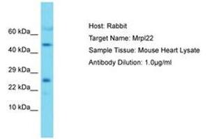 Image no. 1 for anti-Mitochondrial Ribosomal Protein L22 (MRPL22) (AA 91-140) antibody (ABIN6750491)