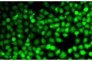 anti-Cyclin E2 (CCNE2) antibody