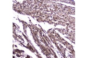 IHC testing of FFPE rat heart tissue with NFIB antibody at 1ug/ml. (NFIB anticorps)