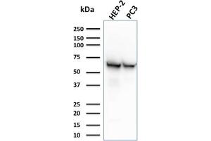 Western Blot Analysis of HEP-2 and PC3 cell lysates using HSP60 Mouse Monoclonal Antibody (CPTC-HSPD1-1). (HSPD1 anticorps)