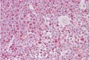 Immunohistochemistry with Thymus tissue at an antibody concentration of 5µg/ml using anti-NFATC2 antibody (ARP38988_P050)