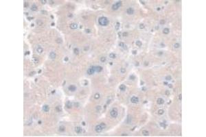 IHC-P analysis of Human Liver Tissue, with DAB staining. (HPR anticorps  (AA 70-332))