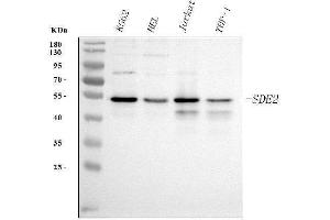 Western blot analysis of SDE2 using anti-SDE2 antibody (ABIN7599603). (C1orf55 anticorps  (AA 10-447))