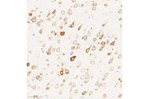 Immunohistochemistry of paraffin embedded rat brain using CHST6 (ABIN7073302) at dilution of 1:2000 (300x lens) (CHST6 anticorps)