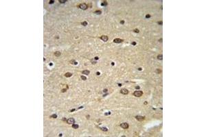 Immunohistochemistry (IHC) image for anti-delta-Like 2 Homolog (DLK2) antibody (ABIN3004005)