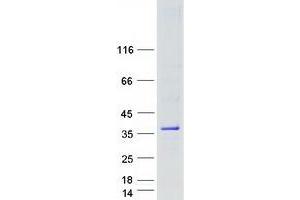 Validation with Western Blot