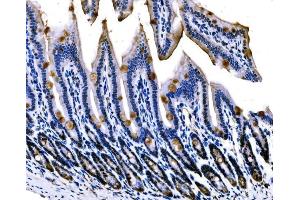 IHC analysis of Sigma1-Receptor/SIGMAR1 using anti-Sigma1-Receptor/SIGMAR1 antibody (ABIN7599011). (SIGMAR1 anticorps  (AA 1-154))