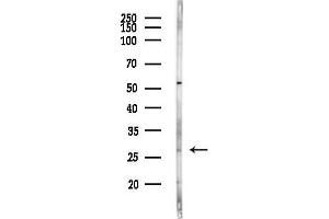 anti-Complement Component 1, Q Subcomponent, A Chain (C1QA) (Internal Region) antibody