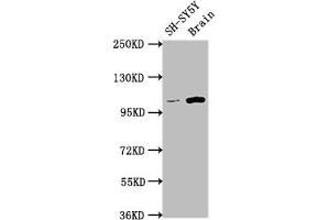 Western Blot Positive WB detected in: SH-SY5Y whole cell lysate, Rat brain tissue All lanes: LGR5 antibody at 1:1500 Secondary Goat polyclonal to rabbit IgG at 1/50000 dilution Predicted band size: 100, 98, 93 kDa Observed band size: 100 kDa (Recombinant LGR5 anticorps)