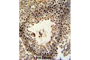 Immunohistochemistry (IHC) image for anti-PHD Finger Protein 13 (PHF13) antibody (ABIN3002222) (PHF13 anticorps)