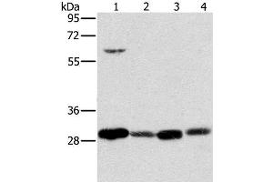 Western Blot analysis of 293T cell and Human testis tissue, A375 cell and Human normal kidney tissue using MRPL28 Polyclonal Antibody at dilution of 1:600