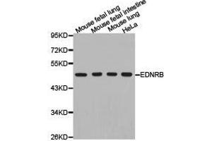 Western Blotting (WB) image for anti-Endothelin Receptor Type B (EDNRB) antibody (ABIN1872425) (EDNRB anticorps)