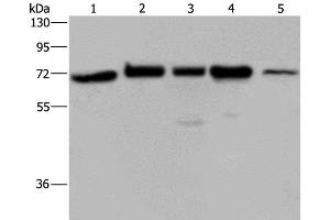 Western Blot analysis of A172, Hela and 293T cell, K562 cell and Human testis tissue using AGFG1 Polyclonal Antibody at dilution of 1:727 (AGFG1 anticorps)