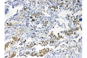 IHC analysis of TMEM107 using anti- TMEM107 antibody . (TMEM107 anticorps  (N-Term))