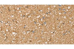 Immunohistochemistry of paraffin-embedded Human brain tissue using SDC3 Polyclonal Antibody at dilution 1:45 (SDC3 anticorps)
