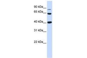 Image no. 1 for anti-Catenin (Cadherin-Associated Protein), beta 1, 88kDa (CTNNB1) (AA 684-733) antibody (ABIN6744377) (CTNNB1 anticorps  (AA 684-733))