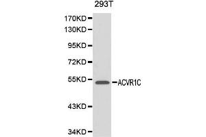 Western blot analysis of 293T cell lysate using ACVR1C antibody. (ACVR1C/ALK7 anticorps  (AA 22-113))
