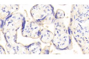 Detection of ATG16L1 in Human Placenta Tissue using Polyclonal Antibody to Autophagy Related Protein 16 Like Protein 1 (ATG16L1) (ATG16L1 anticorps  (AA 342-607))