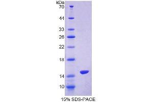 SDS-PAGE analysis of Human S100Z Protein. (S100Z Protéine)