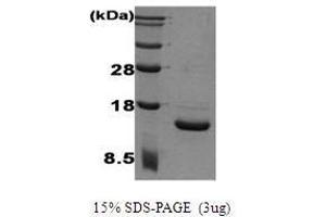 Figure annotation denotes ug of protein loaded and % gel used. (IL-2 Protein (Cys145Ser-Mutant))