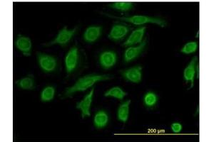 Immunofluorescence (IF) image for anti-Metalloproteinase Inhibitor 2 (TIMP2) antibody (ABIN781825) (TIMP2 anticorps)