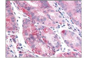Human Stomach: Formalin-Fixed, Paraffin-Embedded (FFPE)