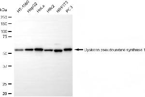 Western blotting analysis using dyskerin pseudouridine synthase 1 antibody (ABIN7798408).